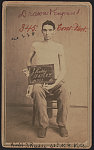 [Private John Ruddy of Co. K and Co. A, 63rd New York Infantry Regiment, without shirt, displaying shoulder wound]