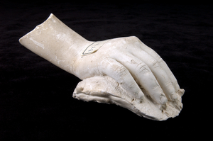 Cast of an Unidentified Right Hand in a Relaxed Position